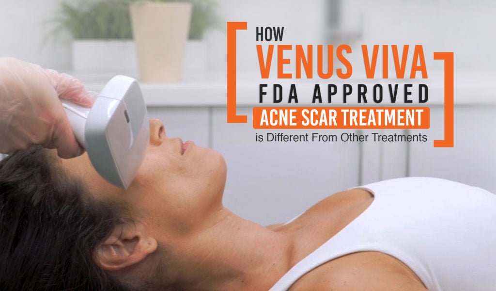 HOW VENUS VIVA FDA APPROVED ACNE SCAR TREATMENT IS DIFFERENT FROM OTHER TREATMENTS - Venus Aesthetics